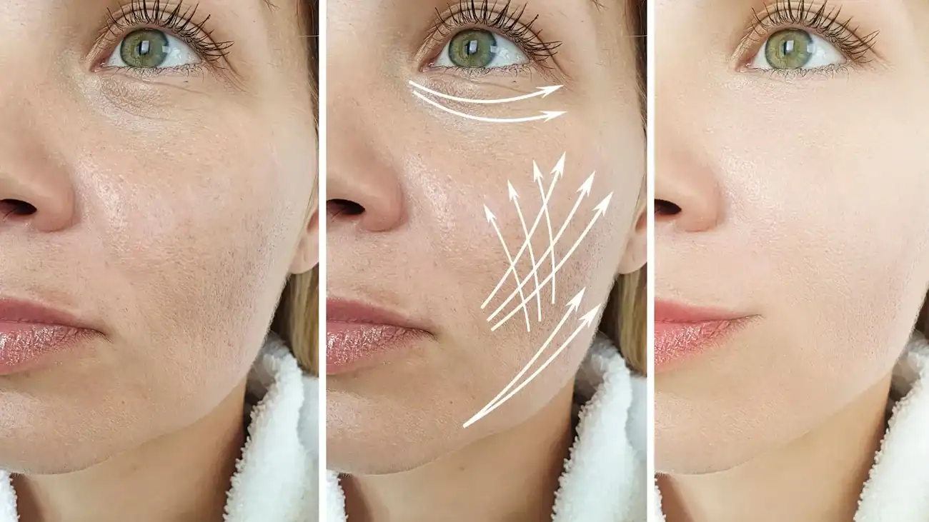 Can One Treatment Really Tackle More Than One Skin Concern Richmond upon Thames?