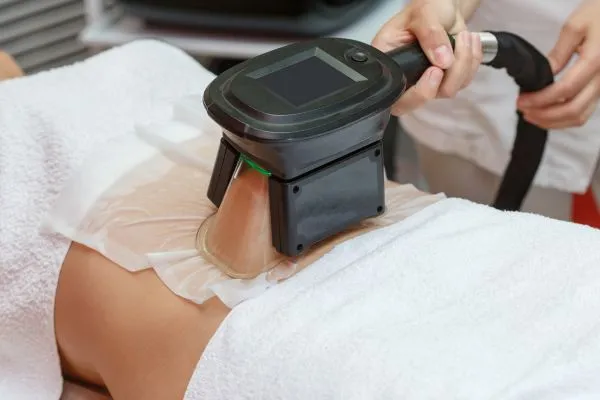Image of person having fat freezing treatment to help weight gain Richmond upon Thames
