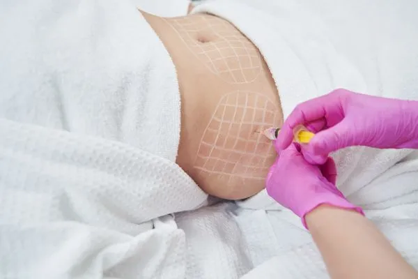 image of fat dissolving injections on love handles to help combat weight gain Richmond upon Thames