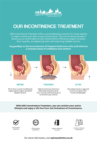 image to show how EMS treatment works for female urinary incontinence Richmond upon Thames