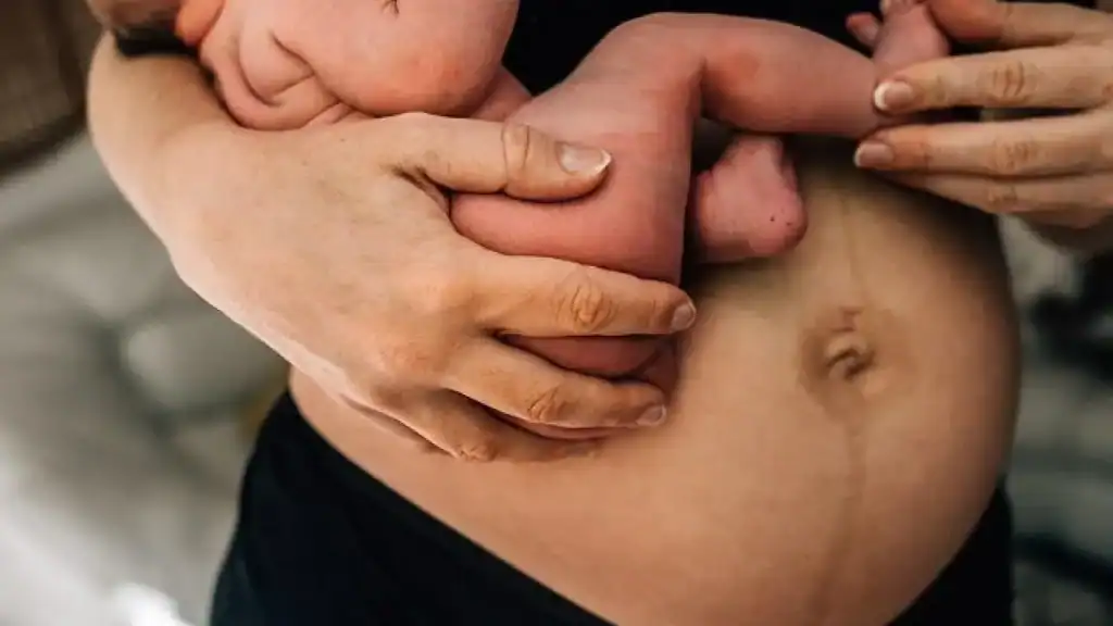 Why Is My Stomach Still Big After Pregnancy Richmond upon Thames?